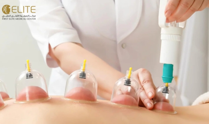 الحجامة ومشاكل الجهاز الهضمي: رؤية طبية تكاملية